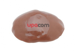 Орган-вставка Neoderm (лапароскопия-26344 LNB) Karl Storz